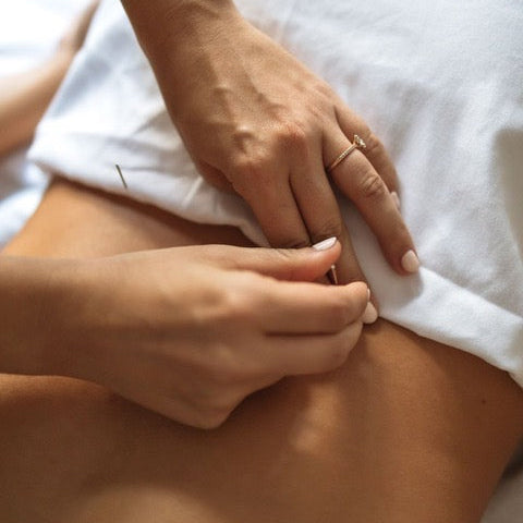 How Acupuncture Supports Hormonal and Emotional Recovery