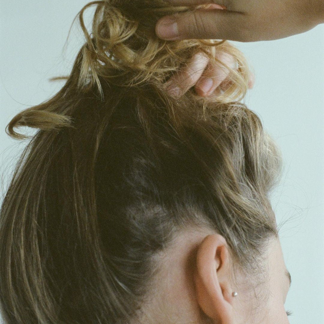 postpartum hair loss