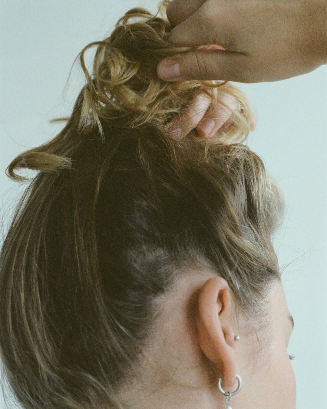 postpartum hair loss